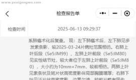 肺腺癌术后一年复查，这是复发转移了吗？