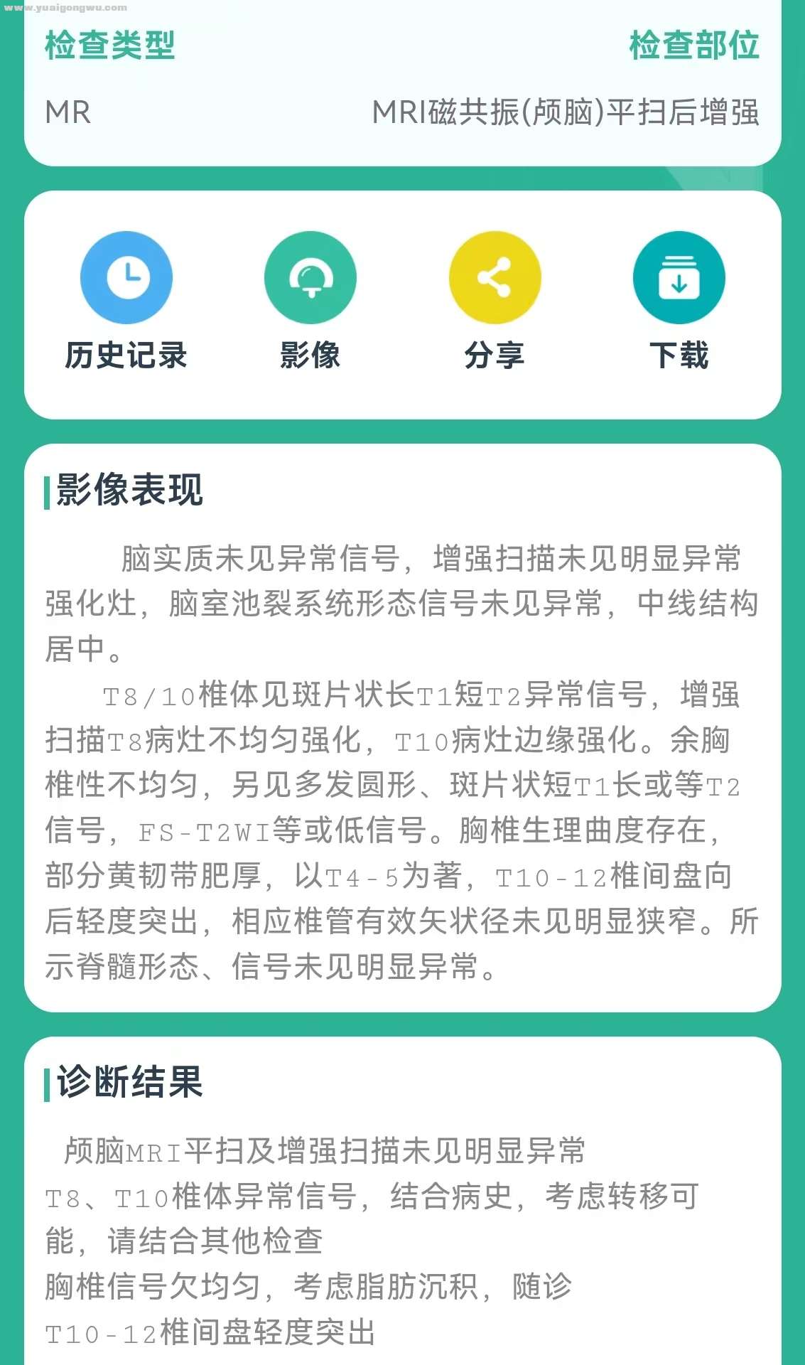 24年4月MR颅脑